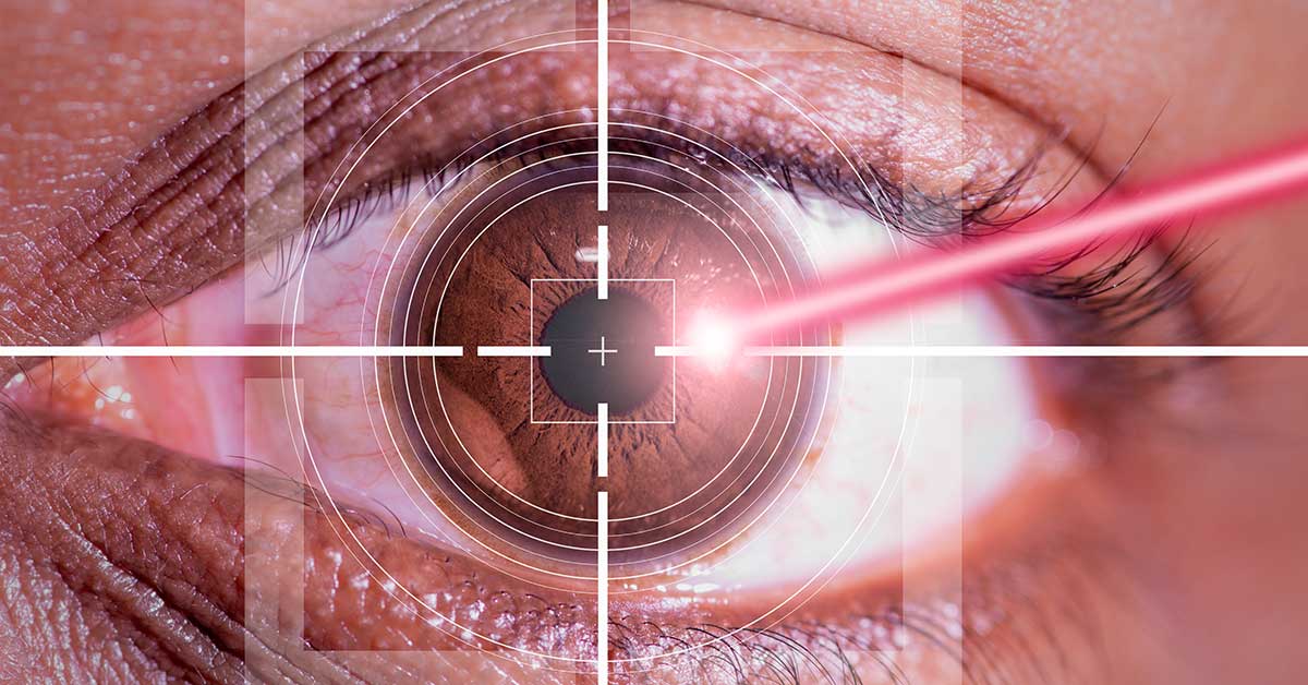 Lazer Göz Ameliyatı Sonrası Katarakt Ameliyatı Yapılabilir mi?
