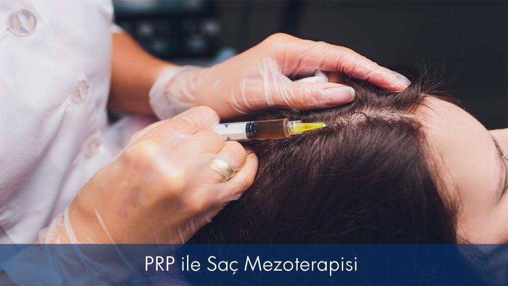 PRP ile Saç Mezoterapisi