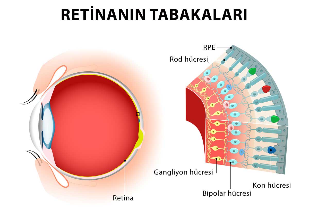 Retina Nedir-Retina Hastalıkları