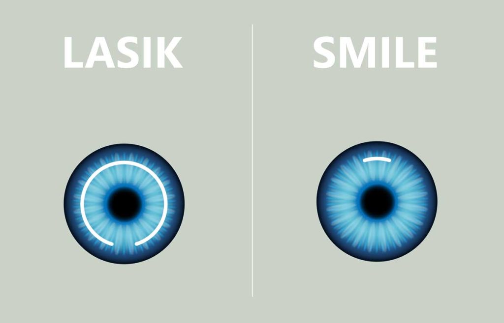 Smile Lazer