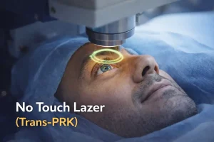 No Touch Lazer (Trans-PRK) sırasında korneaya uygulanan lazer ışınını gösteren göz ameliyatı görseli