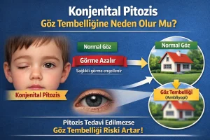 Konjenital pitozis, görme aksını kapatırsa göz tembelliğine (ambliyopi) yol açabilir