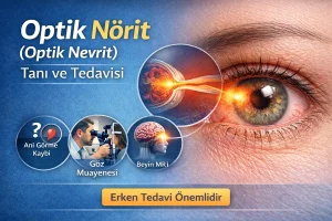 Optik nörit (optik nevrit) tanı ve tedavisi, ani görme kaybı ve göz muayenesi