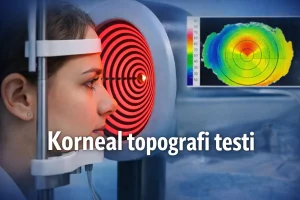Korneal topografi testi sırasında korneanın halka ışıklarla taranmasını gösteren görüntü