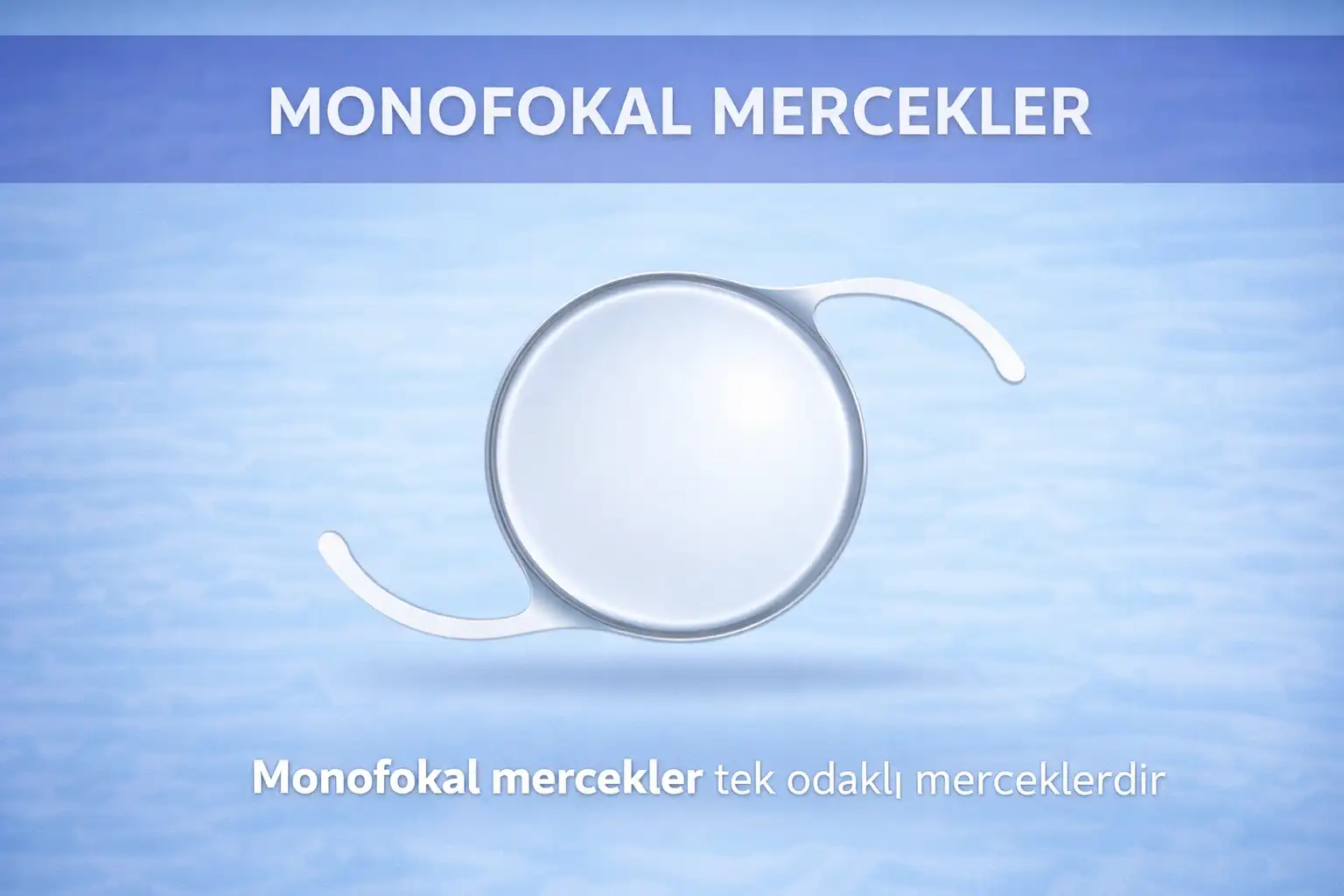 Monofokal Göz İçi Mercekler: Özellikler, Avantajlar ve Sınırlar