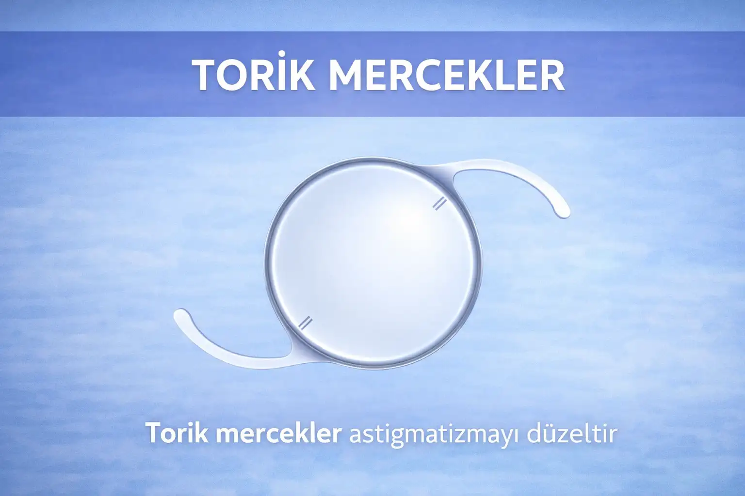 Torik Göz İçi Mercekler: Astigmat Düzeltici Mercekler