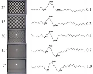 Pattern VEP testinde sol tarafta satranç tahtası şeklindeki desen uyaranlar, sağ tarafta ise bu uyaranlara karşı elde edilen beş farklı pattern VEP yanıtı görülmektedir.