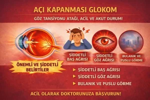 Açı kapanması glokomu belirtileri: ani göz ağrısı, baş ağrısı, bulantı-kusma ve görme bulanıklığını anlatan acil durum görseli