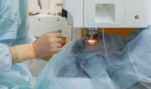 SMILE lazer ile FemtoLASIK arasındaki farkları anlatan göz lazer ameliyatı görseli