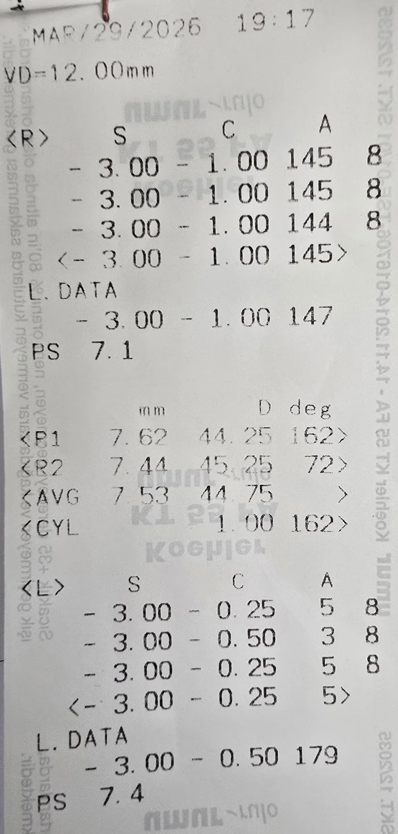 Otorefraktometre çıktı fişi: sağ (R) ve sol (L) göz için S (sferik), C (silindir), A (aks) ölçümleri ve R1/R2 kornea değerleri